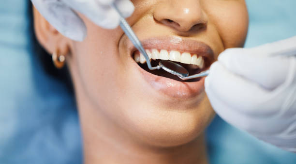 Best Broken or Chipped Tooth Repair in New Kensington, PA